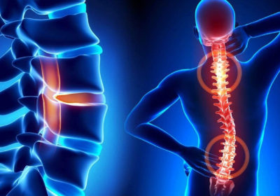 Read more about Persistent musculoskeletal pain sufferers invited to take part in research project