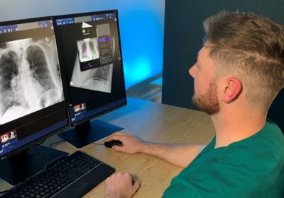 Read more about New AI technology solution to help diagnose lung cancer quicker in South Tyneside